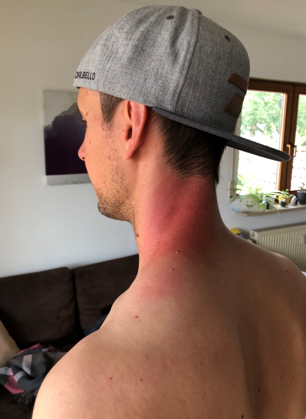 Nach der Behandlung