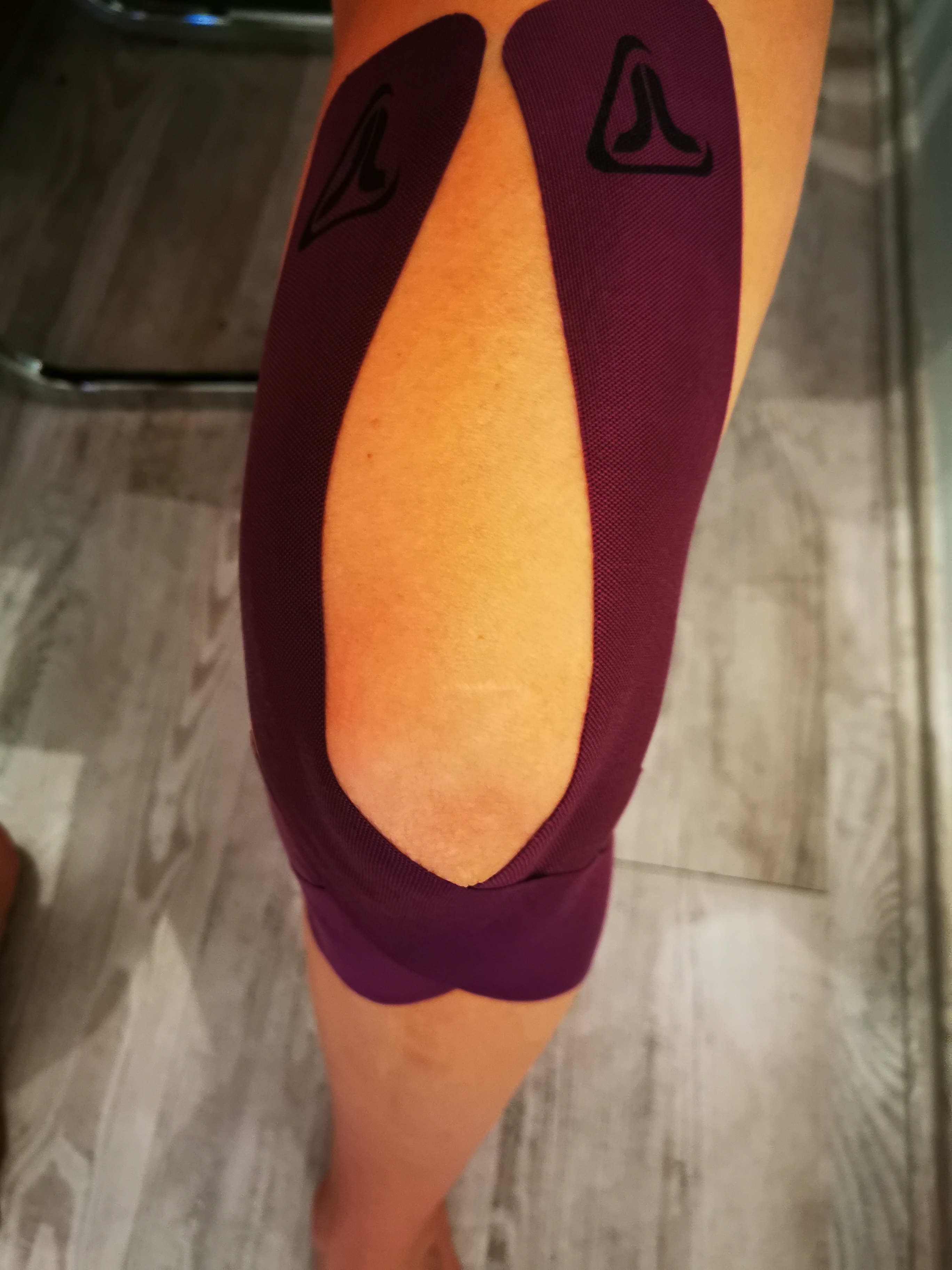 Knie