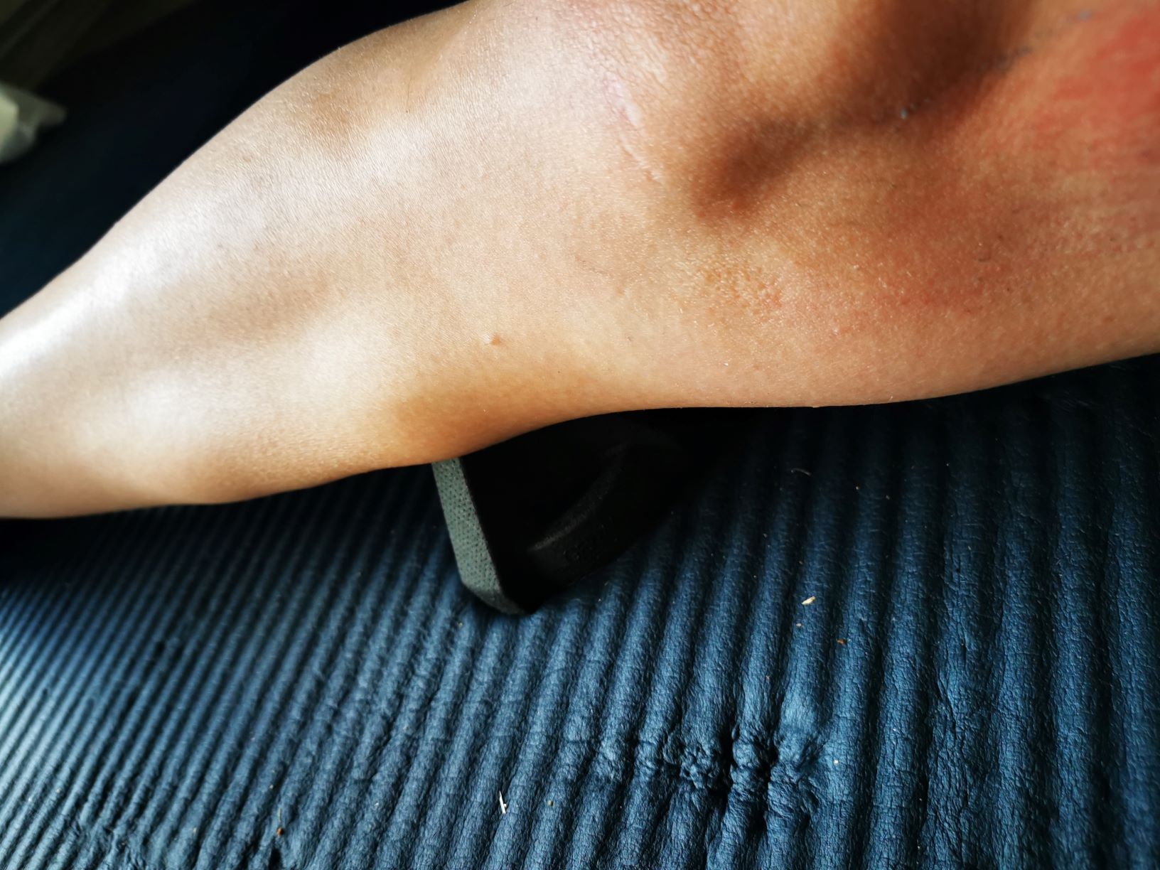 EPP Tool im Wadenbereich