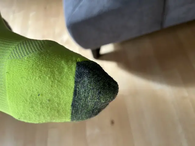 Zehen1