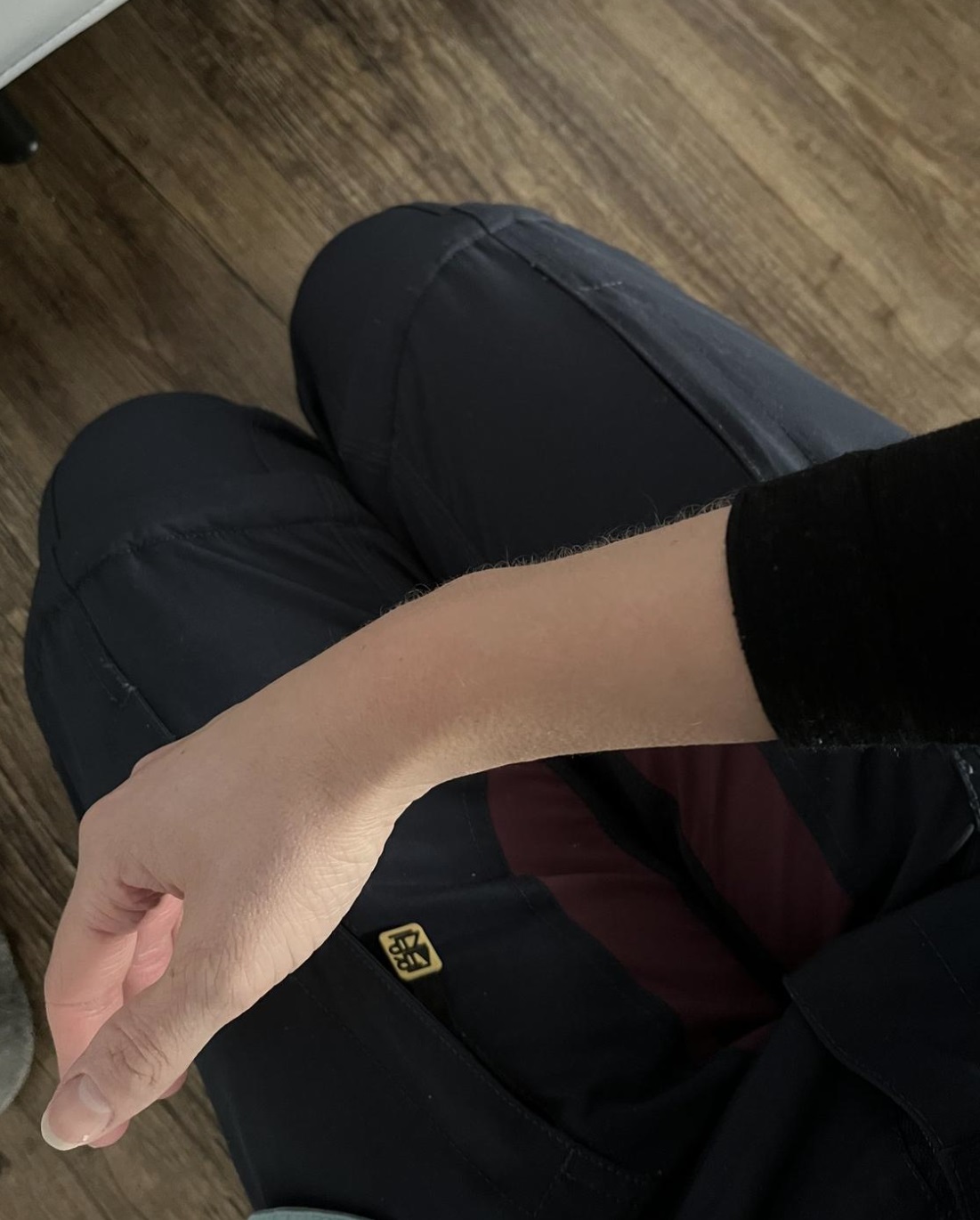 rotes Handgelenk nicht mehr ersichtlich, aber kurzer Ärmel