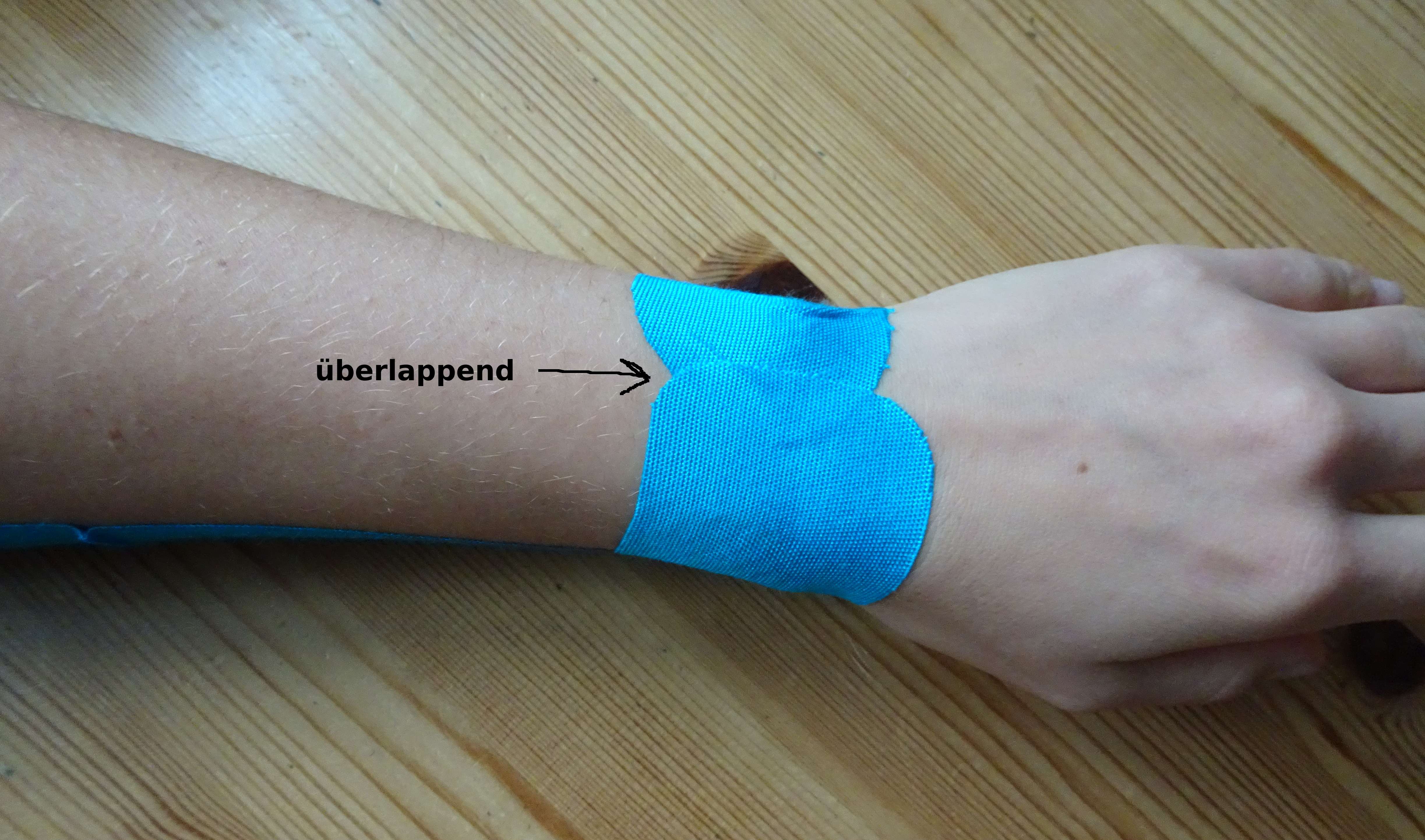 Überlappend